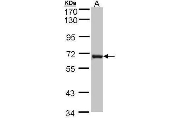 DENND1B anticorps  (Center)