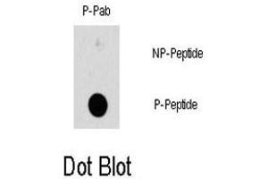 Dot blot analysis of HSPB1 (phospho S78) polyclonal antibody  on nitrocellulose membrane.