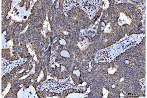 IHC analysis of NDUFS5 using anti-NDUFS5 antibody (ABIN7598943).