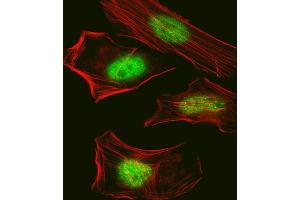 Immunofluorescence (IF) image for anti-SUMO (pan) antibody (ABIN2997018)
