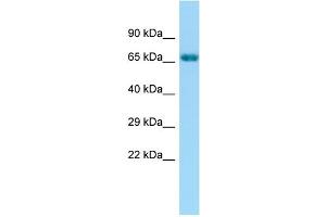 WB Suggested Anti-GRK6 Antibody Titration: 1. (GRK6 anticorps  (C-Term))
