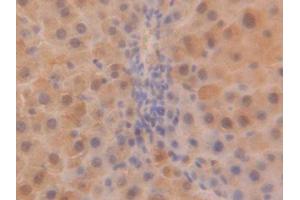 DAB staining on IHC-P; Samples: Rat Liver Tissue (SOD1 anticorps  (AA 2-154))