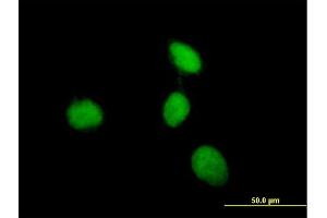 Immunofluorescence of purified MaxPab antibody to MEN1 on HeLa cell. (Menin anticorps  (AA 1-575))