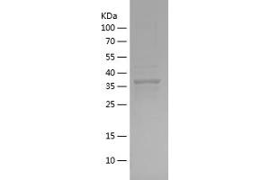 Afamin (AFM) (AA 22-143) protein (His-IF2DI Tag)