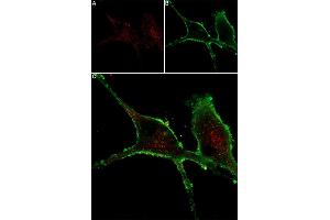Live cell imaging of mouse NGF 2. (NGF 2.5S protein (Atto 647N))