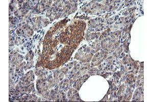 Image no. 1 for anti-Dynamin 1-Like (DNM1L) antibody (ABIN1497872)