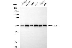 Western blotting analysis using FSCN1 antibody (ABIN7798578).