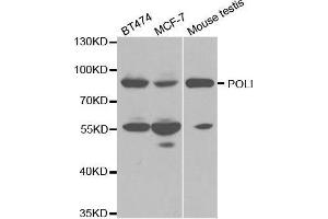 Western blot analysis of extracts of various cell lines, using POLI antibody. (POLI anticorps  (AA 50-350))
