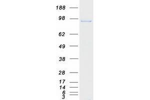 Validation with Western Blot