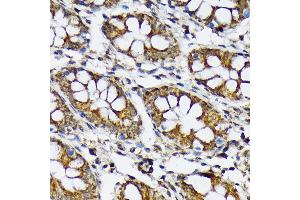 Immunohistochemistry of paraffin-embedded human colon using p70 S6 Kinase 2 Rabbit mAb (ABIN7270034) at dilution of 1:100 (40x lens).