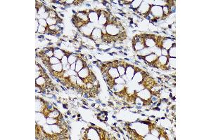 Immunohistochemistry of paraffin-embedded human colon using p70 S6 Kinase 2 Rabbit mAb (ABIN7270034) at dilution of 1:100 (40x lens). (RPS6KB2 anticorps)