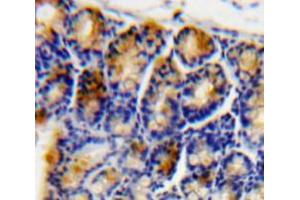 Used in DAB staining on fromalin fixed paraffin-embedded Bowels tissue (ATF4 anticorps  (AA 126-291))