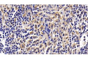 Detection of ATG16L1 in Human Spleen Tissue using Polyclonal Antibody to Autophagy Related Protein 16 Like Protein 1 (ATG16L1) (ATG16L1 anticorps  (AA 342-607))