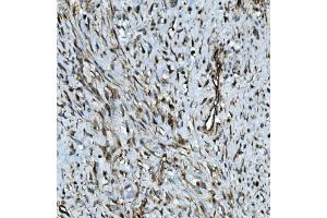 IHC analysis of MMP2 using anti-MMP2 antibody (ABIN7601677).