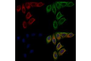 ABIN6263792 and ABIN6277681 staining Hela cells by IF/ICC. (OCA2 anticorps  (N-Term))