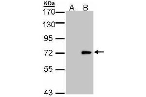 WB Image Western Blot analysis of ULK4 expression in transfected 293T cell line by ULK4 polyclonal antibody. (ULK4 anticorps  (Internal Region))