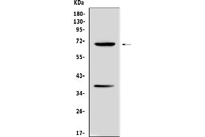 Western blot analysis of Alpha 1 Fetoprotein using anti-Alpha 1 Fetoprotein antibody (ABIN5692976). (alpha Fetoprotein anticorps  (AA 19-254))
