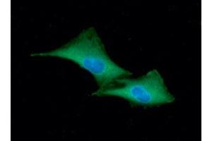 ICC/IF analysis of GSTP1 in A549 cells line, stained with DAPI (Blue) for nucleus staining and monoclonal anti-human GSTP1 antibody (1:100) with goat anti-mouse IgG-Alexa fluor 488 conjugate (Green)