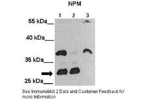Lanes:   Lane 1: 25ug MIA PaCa-2 cell lysate Lane 2: 25ug MDA-MB-231 cell lysate Lane 3: 25ug Huh-7 cell lysate  Primary Antibody Dilution:   1:2000  Secondary Antibody:   Anti-rabbit-HRP  Secondary Antibody Dilution:   1:5000  Gene Name:   NPM1  Submitted by:   Andrei L. (NPM1 anticorps  (C-Term))