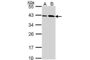 WB Image Sample (30 ug of whole cell lysate) A: A431 , B: H1299 10% SDS PAGE antibody diluted at 1:1000