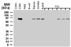 Western blot analysis of MALT1 expression. (MALT1 anticorps)