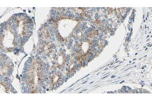 ABIN6277125 at 1/100 staining Human prostate tissue by IHC-P.