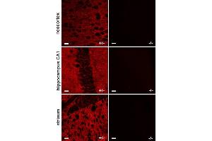 Immunohistochemistry (IHC) image for anti-Solute Carrier Family 1 (Glial High Affinity Glutamate Transporter), Member 2 (SLC1A2) (AA 146-161), (Extracellular Domain) antibody (ABIN1742506)