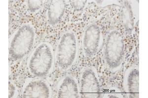 Immunoperoxidase of monoclonal antibody to IRF4 on formalin-fixed paraffin-embedded human colon.