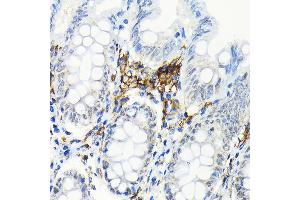 Immunohistochemistry of paraffin-embedded human colon using HLA-DRB1 Rabbit mAb (ABIN7268374) at dilution of 1:100 (40x lens).