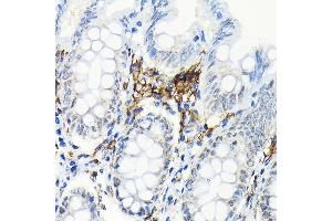 Immunohistochemistry of paraffin-embedded human colon using HLA-DRB1 Rabbit mAb (ABIN7268374) at dilution of 1:100 (40x lens). (HLA-DRB1 anticorps)