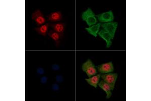 ABIN6264642 and ABIN6276374 staining Hela cells by IF/ICC. (Retinoic Acid Receptor alpha anticorps  (N-Term))
