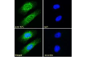 ABIN185185 Immunofluorescence analysis of paraformaldehyde fixed HeLa cells, permeabilized with 0. (TCP1 alpha/CCTA anticorps  (C-Term))