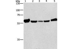 Western Blot analysis of Mouse liver tissue and Raji cell, hela, hepG2 and A549 cell using CAT Polyclonal Antibody at dilution of 1:266. (Catalase anticorps)