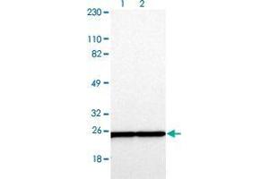 Western blot analysis of Lane 1: Human cell line RT-4 Lane 2: Human cell line U-251MG sp with RPL9 polyclonal antibody .