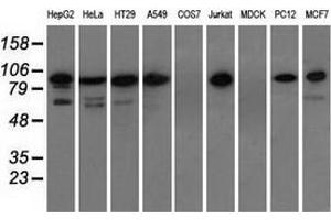 Western blot analysis of extracts (35 µg) from 9 different cell lines by using anti-TACC3 monoclonal antibody. (TACC3 anticorps)