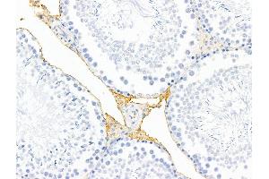 ABIN7094795 and ABIN7098846 at 1/100 staining Rat testis tissue by IHC-P. (HHIP anticorps  (C-Term))