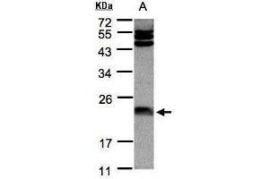 WB Image Sample(30 μg of whole cell lysate) A:Hep G2, 12% SDS PAGE antibody diluted at 1:1000 (FTL anticorps)