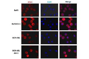 Immunofluorescence analysis in Ba/F3 cells with Ahi1 monoclonal antibody, clone 645s3( Cat # MAB8962 ) at 1 : 200 dilution. (AHI1 anticorps  (C-Term))
