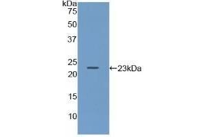 Detection of Recombinant Iga, Mouse using Polyclonal Antibody to Immunoglobulin Associated Alpha (Iga)