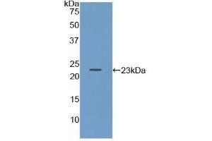 Detection of Recombinant Iga, Mouse using Polyclonal Antibody to Immunoglobulin Associated Alpha (Iga) (CD79a anticorps  (AA 30-193))