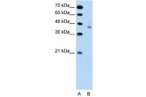 WB Suggested Anti-DHX30  Antibody Titration: 0. (DHX30 anticorps  (N-Term))