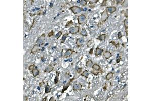 IHC analysis of CD97/Adgre5 using anti-CD97/Adgre5 antibody (ABIN7601103). (ADGRE5 (AA 287-816) anticorps)