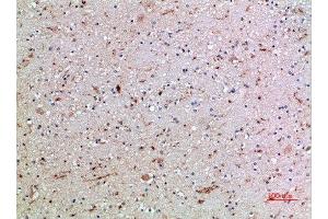 Immunohistochemical analysis of paraffin-embedded human-brain, antibody was diluted at 1:200 (CD16a, CD16b (AA 100-150) anticorps)