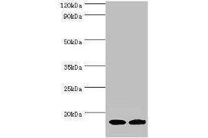 Western blot All lanes: Complexin-2 antibody at 6 μg/mL Lane 1: Rat brain tissue Lane 2: A549 whole cell lysate Secondary Goat polyclonal to rabbit IgG at 1/10000 dilution Predicted band size: 15 kDa Observed band size: 15 kDa (CPLX2 anticorps  (AA 1-134))