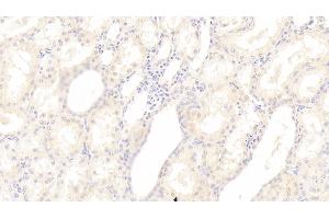 Detection of SGPL1 in Human Kidney Tissue using Polyclonal Antibody to Sphingosine 1 Phosphate Lyase 1 (SGPL1) (SGPL1 anticorps  (AA 239-493))