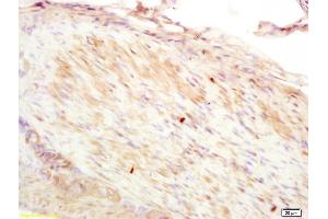 Formalin-fixed and paraffin embedded rat stomach muscle labeled with Anti-CNN2 Polyclonal Antibody, Unconjugated (ABIN1385667) at 1:200 followed by conjugation to the secondary antibody and DAB staining. (CNN2 anticorps  (AA 118-150))
