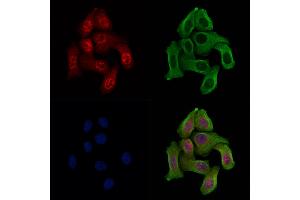 Phospho-WEE1 (Ser123) Antibody staining Hela cells(heat shock treatment) by IF/ICC. (WEE1 anticorps  (pSer123))