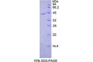SDS-PAGE analysis of Dog beta 2-Microglobulin Protein. (beta-2 Microglobulin Protéine)