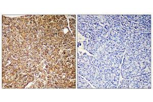 Immunohistochemistry (IHC) image for anti-Phosphoinositide-3-Kinase, Catalytic, gamma Polypeptide (PIK3CG) (Internal Region) antibody (ABIN1852676) (PIK3 gamma anticorps  (Internal Region))