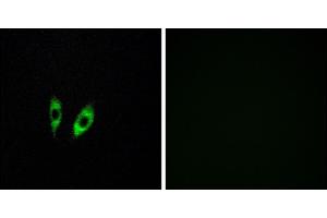 Immunofluorescence analysis of HeLa cells, using GP antibody. (GPR156 anticorps)